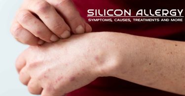 A man itching on his hands due to silicone allergy (concept).